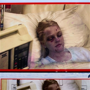 Drew Barrymore 50 First Dates Injury Photo