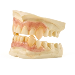 Johnny Depp Into the Woods Teeth Appliances